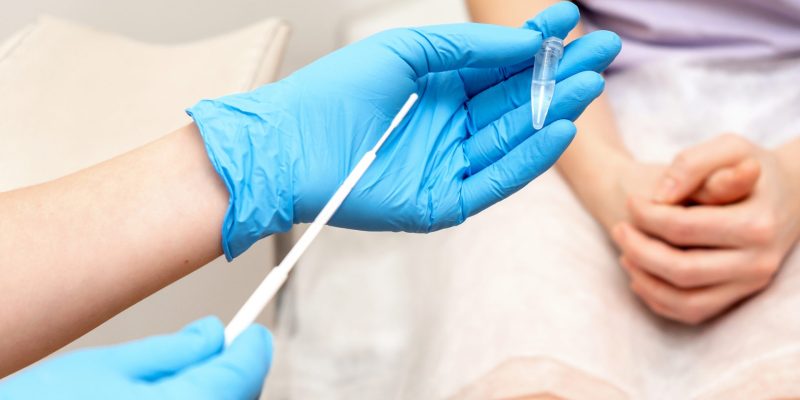 HPV Testi Öncesi Hazırlık