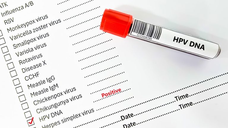 HPV Testi Sonucu Ne Zaman Çıkar?