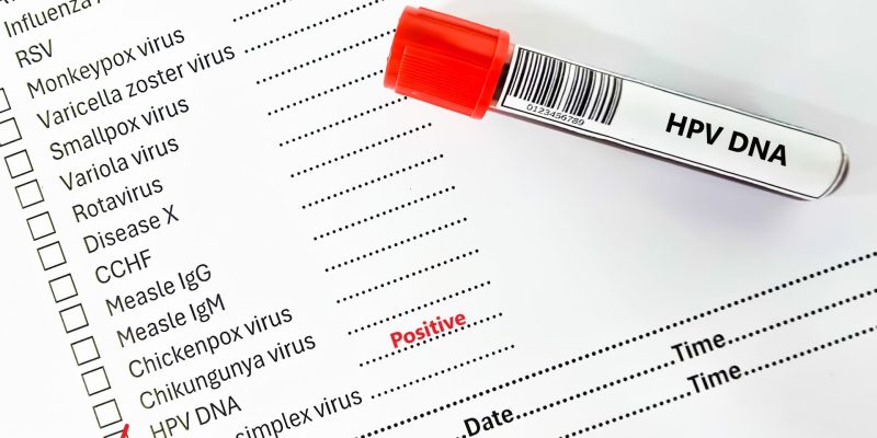 HPV Testi Sonucu Ne Zaman Çıkar?