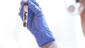 HPV Testi Ne Zaman Yapılmalı?