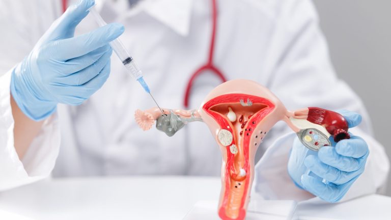 Hamilelikte HPV Testi