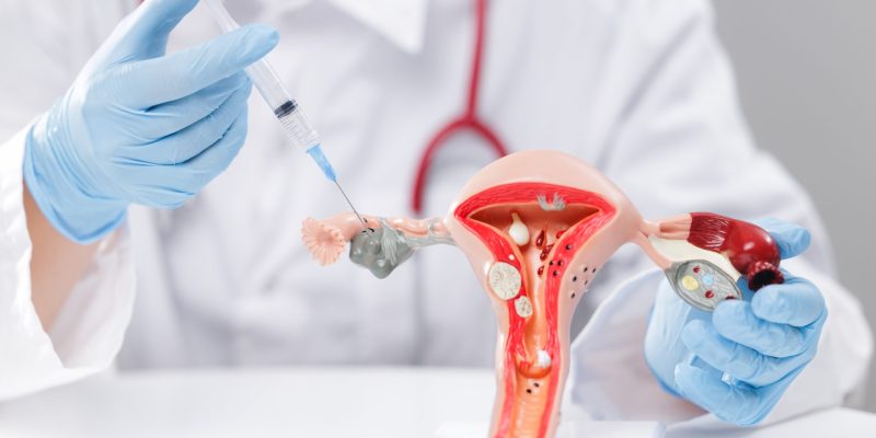 Hamilelikte HPV Testi