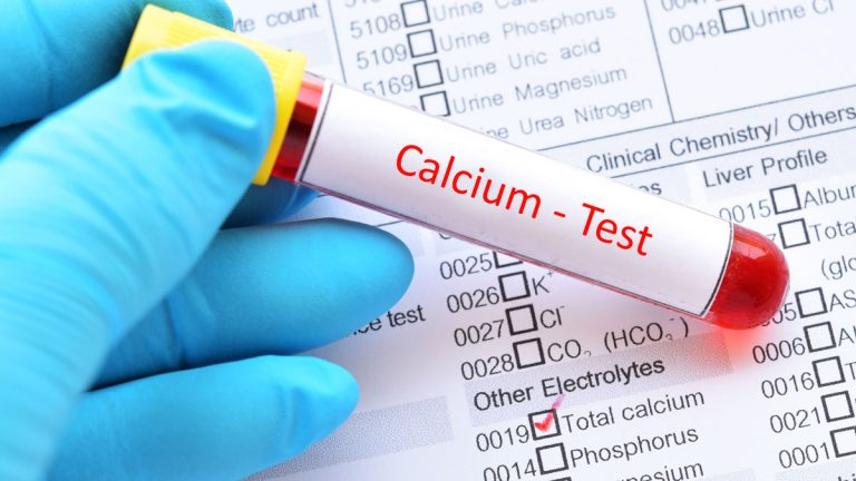 Kalsiyum (CA) Testi