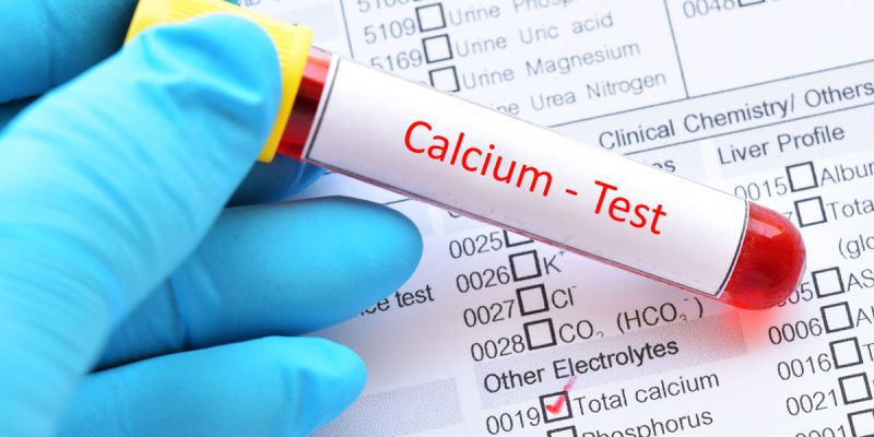 Kalsiyum (CA) Testi Nedir?