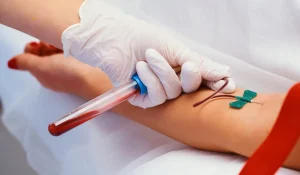 Anti Kardiyolipin (ACA) IgA Testi Nedir?