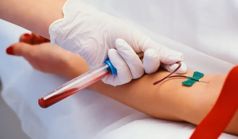 Anti Kardiyolipin (ACA) IgA Testi