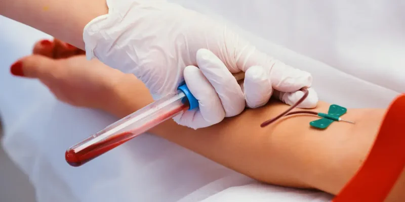 Anti Kardiyolipin (ACA) IgA Testi