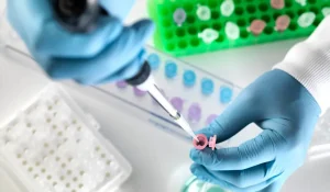 Anti Kardiyolipin (ACA) IgG Testi Nedir?