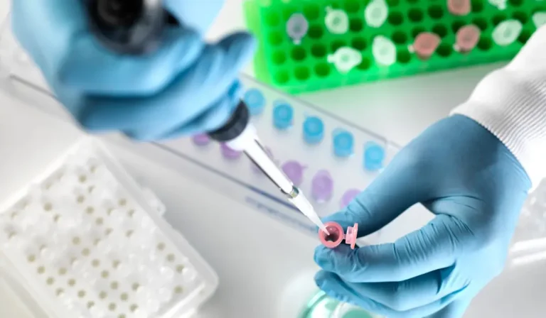 Anti Kardiyolipin (ACA) IgG Testi