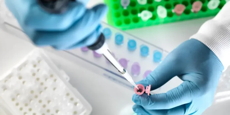 Anti Kardiyolipin (ACA) IgG Testi