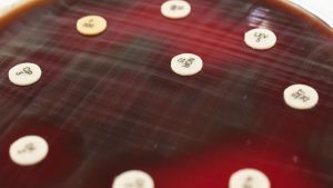 Antibiyogram Duyarlılık Testi Nedir?