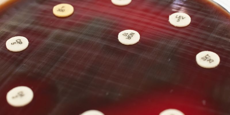 Antibiyogram Duyarlılık Testi Nedir?