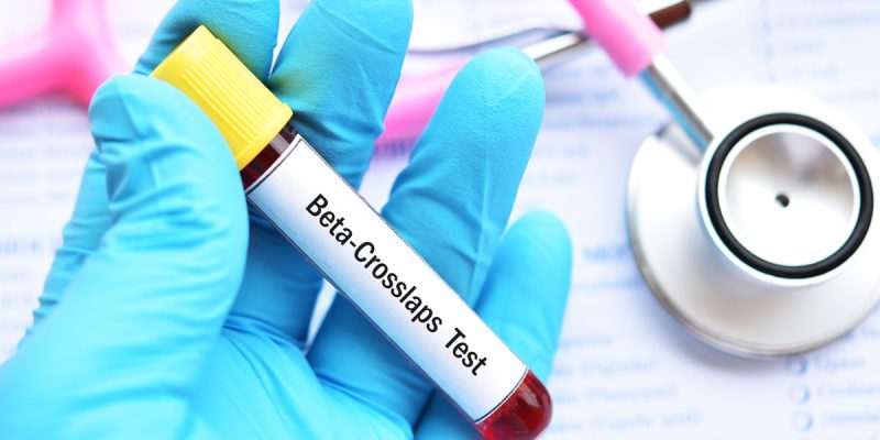 Beta-CTX Testi