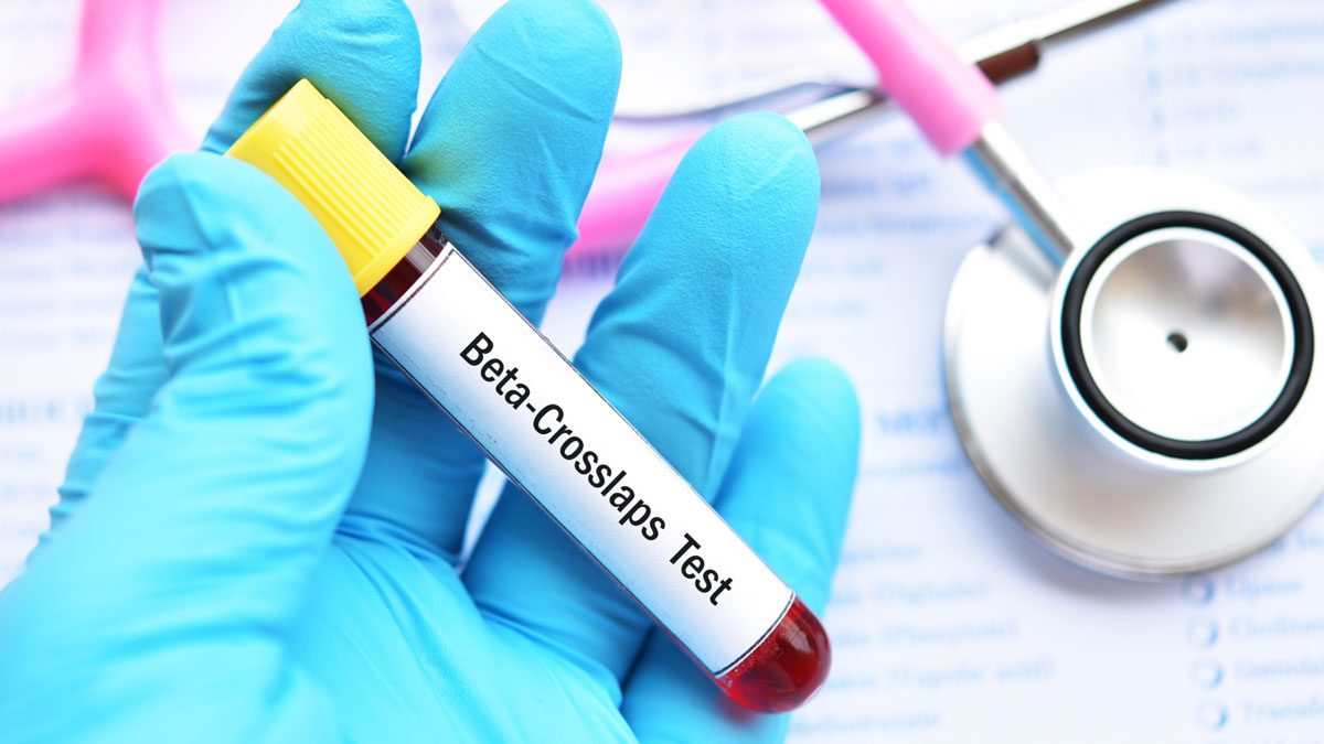 Beta-CTX Testi