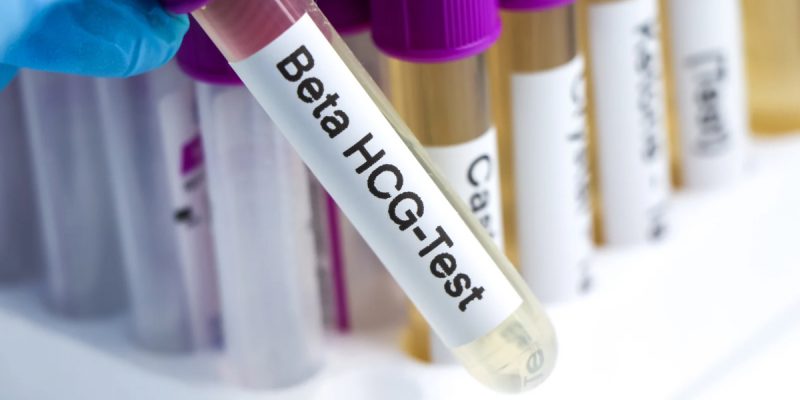 Beta HCG Testi