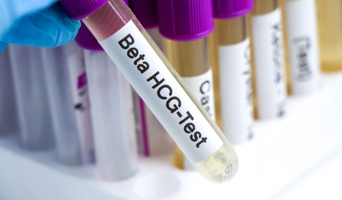 Beta HCG Testi