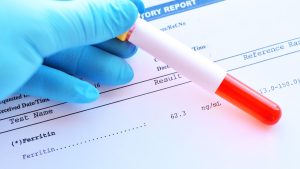 Ferritin Testi