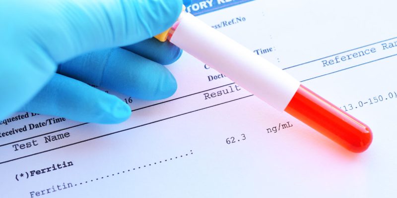 Ferritin Testi
