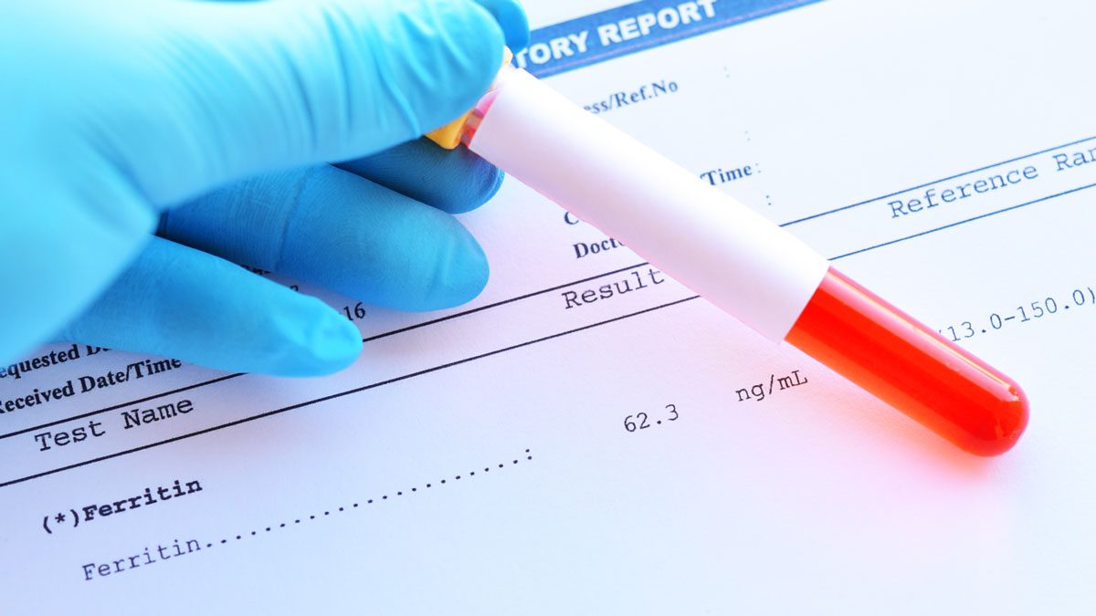 Ferritin Testi