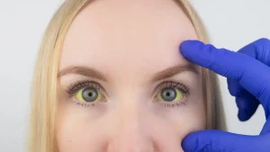 Hepatit C Belirtileri Nelerdir?