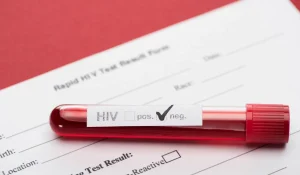 HIV Belirtileri Ne Zaman Başlar?