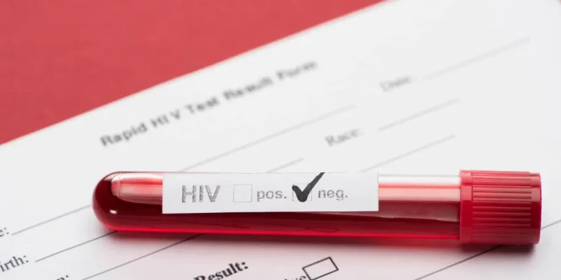 HIV Belirtileri Ne Zaman Başlar?