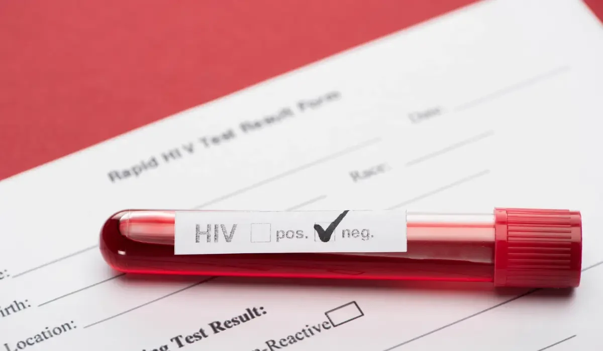 HIV Belirtileri Ne Zaman Başlar?