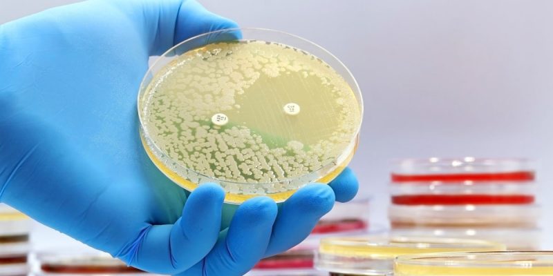 İdrar Kültürü Nedir?