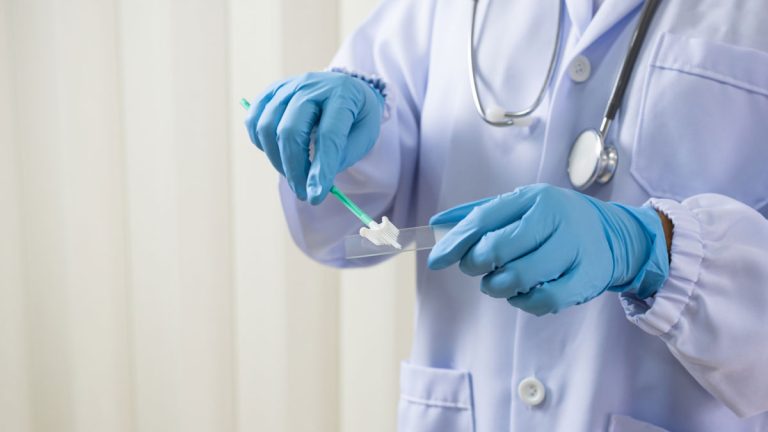 Kadınlarda HPV Testi Nasıl Yapılır?