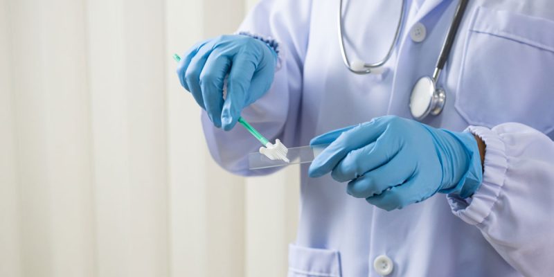 Kadınlarda HPV Testi Nasıl Yapılır?