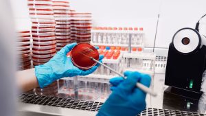 Kültür Antibiyogram Testi Nedir?