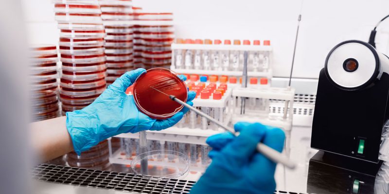 Kültür Antibiyogram Testi Nedir?