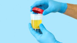 Tam İdrar Tahlili Nedir?