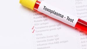 Toxoplasma IgG Testi