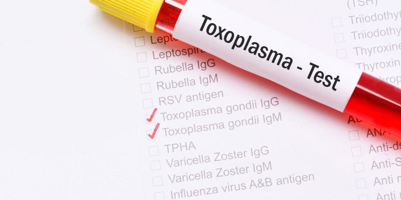 Toxoplasma IgG Testi