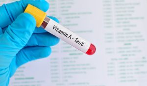 Vitamin A (Retinol) Testi Nedir?