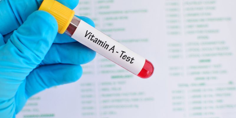 Vitamin A (Retinol) Testi