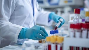 Candida Albicans IgM Testi