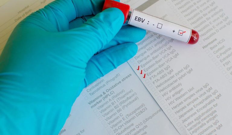 EBV DNA PCR Testi