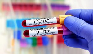HDL Kolesterol Testi Nedir?