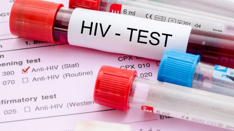 HIV Testi Fiyatı