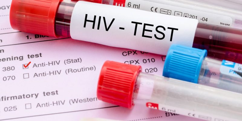 HIV Testi Fiyatı