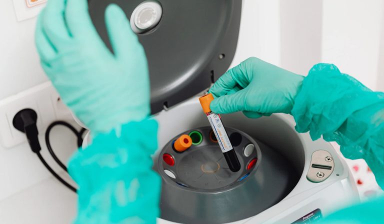 Psödokolinesteraz Testi