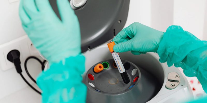 Psödokolinesteraz Testi