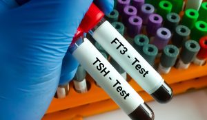 FT3 (Serbest T3) Testi