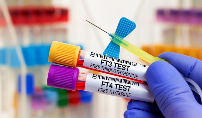 FT4 (Serbest Tiroksin) Testi