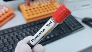 Parvovirüs B19 IgG Testi
