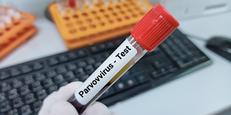 Parvovirüs B19 IgG Testi