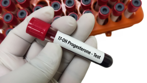 17-OH Progesteron Testi