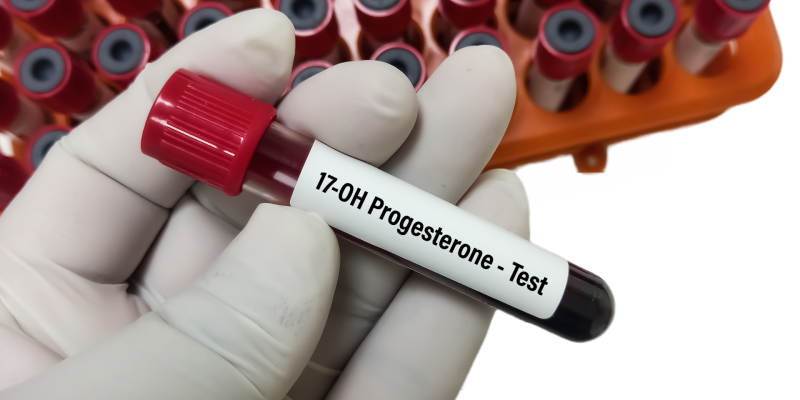 17-OH Progesteron Testi